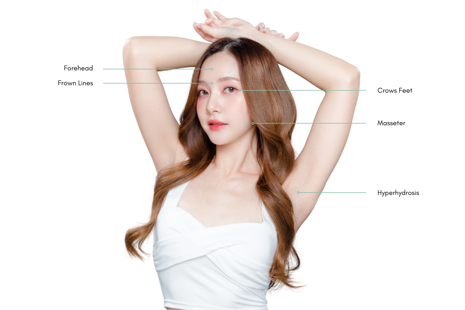 botox-area-of-application-2-2