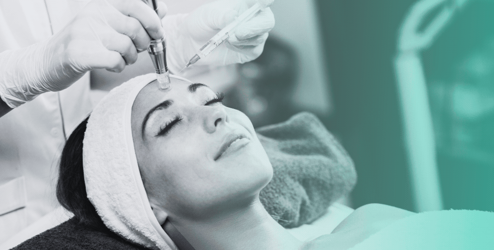 Microneedling