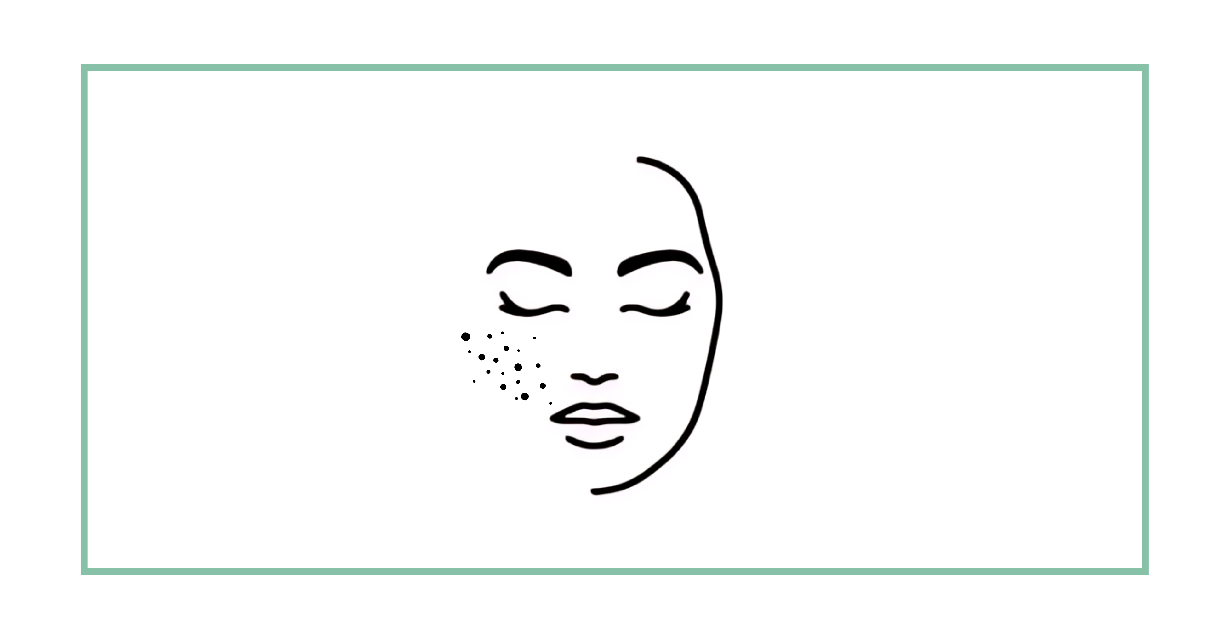 Pigmentation